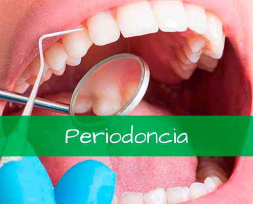 tratamientos periodoncia