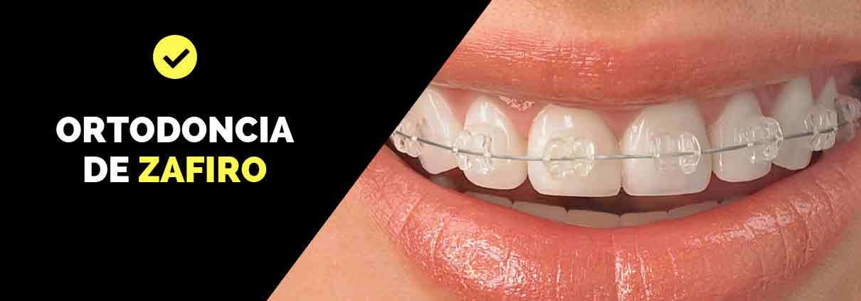 Brackets transparentes Zaragoza